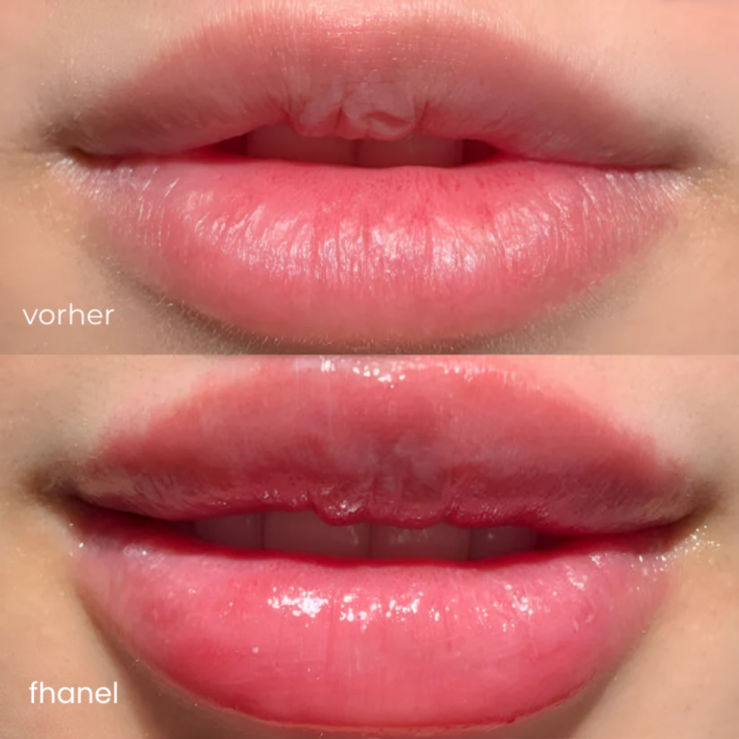 LipBoost® - Das Original