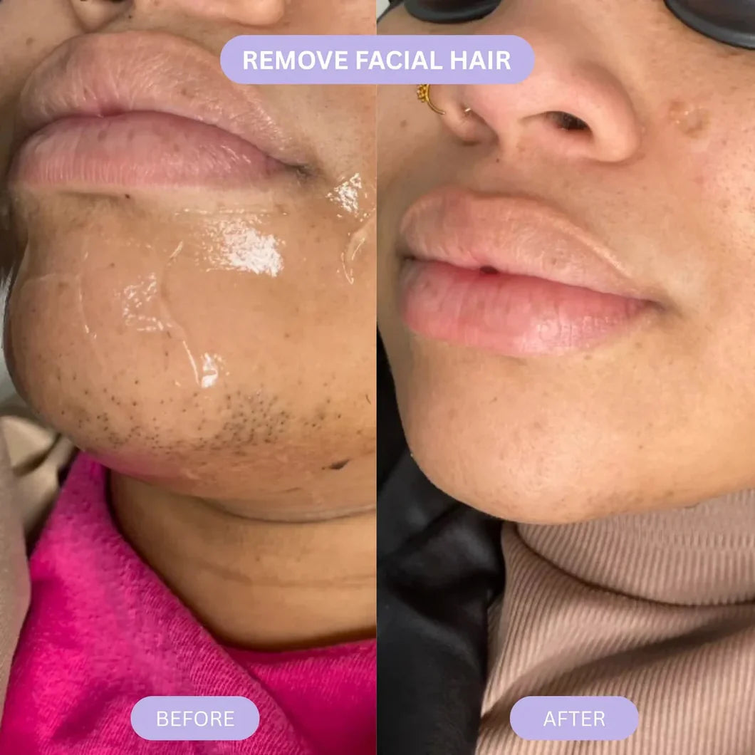 Rotundus  Oil of Cyperus